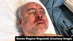 აქციაზე დაკავების შემდეგ ნაცემი ქაცარავა. 14 მაისი, 2024 წ.