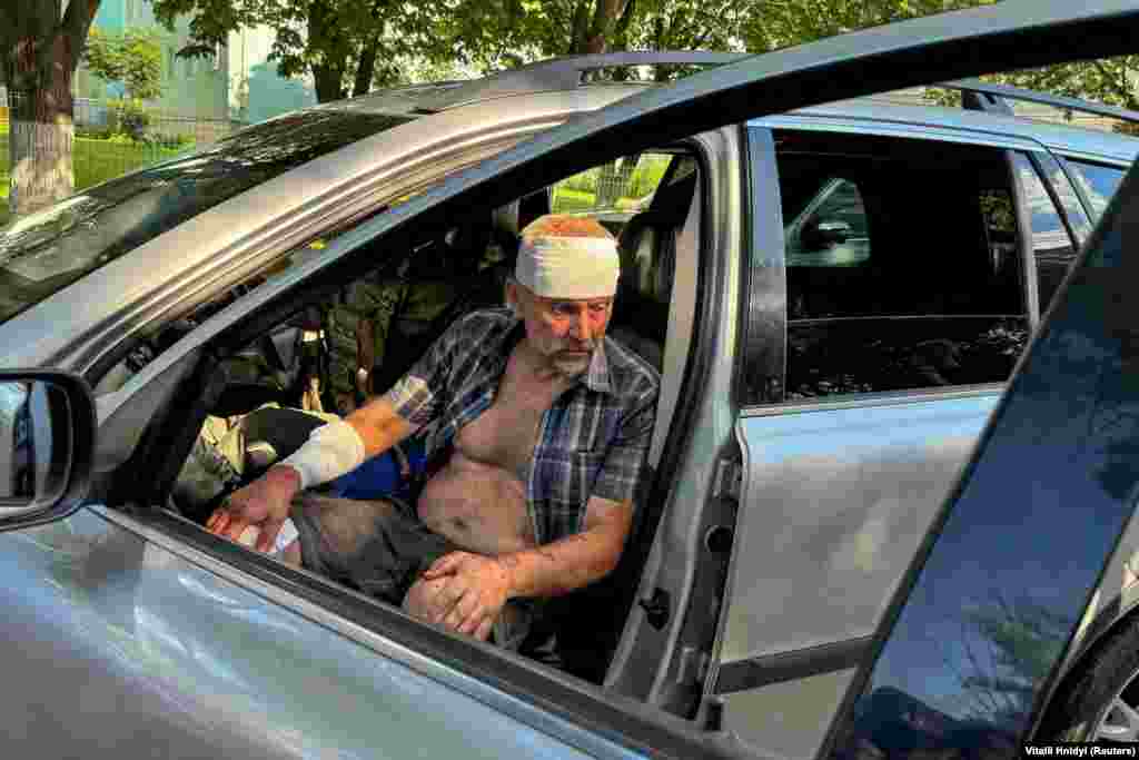 Один из раненых при ударе по почтовому терминалу. Глава Харьковской областной военной администрации Олег Синегубов сообщил, что, по предварительным данным, удар нанесли российские войска двумя ракетами комплекса С-300. Сирены прозвучали лишь за несколько секунд до взрыва, люди не успели эвакуироваться.