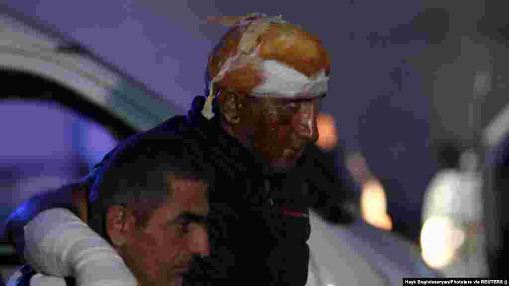 Muškarac povrijeđen u eksploziji u skladištu goriva u blizini Stepanakerta, u Nagorno-Karabahu, dobija pomoć iz kola hitne pomoći po dolasku u centar za opekotine u Jerevanu. Ombudsman otcijepljenog regiona Gegham Stepanian rekao je za RSE da je potvrđeno da je 68 ljudi poginulo u eksploziji, koja se dogodila kada su ljudi koji su htjeli pobjeći u Jermeniju stajali u redu da natoče gorivo u automobile. Uzrok eksplozije nije utvrđen.