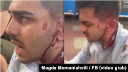 ნაცემი აქტივისტი ნიკო მანაგაძე