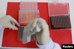 Tehničar u laboratoriji razblažuje uzorke seruma živine za ELISA test za otkrivanje antitijela na virus ptičjeg gripa u Referentnoj laboratoriji Svjetske organizacije za zdravlje životinja u Kampinasu, Brazil, 25. aprila 2023.
