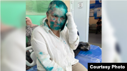 یلنا میلاچینا پیشتر به ویژه با تحقیقاتش درباره اعدامهای غیرقانونی در چچن، خشم مقامهای این جمهوری را برانگیخت