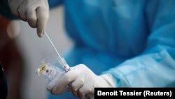 Testovi za korona virus traže kompleksne i čiste reagense do kojih je teže doći tokom pandemije Covid-19.