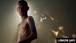 Dmitro Kozackij, šef pres-službe Azovske brigade, fotograf i branitelj Mariupolja, pokazuje svoje iscrpljeno tijelo nakon oslobađanja iz ruskog zarobljeništva.