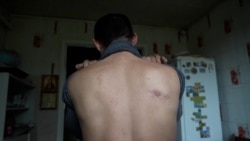 'They Electrocuted Us': Russian Torture Chambers Found In Izyum 'They Electrocuted Us': Russian Torture Chambers Found In Izyum