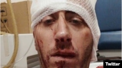 Novinar Vladimir Kovačević iz BNTV nakon napada u nedjelju 26. avgusta 2018.