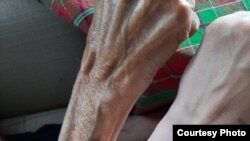 მარიუპოლის მცხოვრებმა ქალმა ფეისბუკზე გამოაქვეყნა მარიუპოლში ჩარჩენილი ბიძის ხელის ფოტო, რომელმაც ქალაქის ალყისა და ოკუპაციის დროს სხეულის წონის თითქმის მეხუთედი დაკარგა.