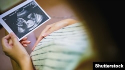 Žena gleda fotografiju bebe sa ultrazvuka, 2021.