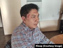 Bolot Temirov ubrzo nakon što je pretučen.