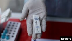 Iz SZO navode da je XBB.1.5 najprenosiviji podsoj omikrona koji je do sada otkriven.