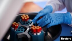 Uzroci za testiranje