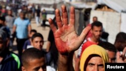Palestinac pokazuje mrlju od krvi na dlanu nakon što je nosio ranjene u izraelskom napadu koji su čekali na humanitarnu pomoć, Kan Junis, jugu Pojasa Gaze, 29. maja 2025.