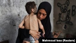 Palestinska majka Samah Matar drži pothranjenog sina Youssefa, koji boluje od cerebralne paralize, 24. jula 2025.