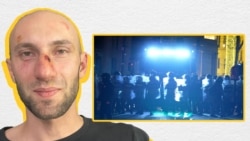 რატი ბოქოლიშვილს გარდა სახის დაზიანებისა, სისხლჩაქცევები და დალურჯებები აქვს ტანზეც;