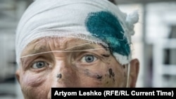 Ivan Grigorijevič je otišao u hitnu pomoć zbog promrzlih prstiju na nozi, ali je dobio površan tretman. "Nisu ih ni pogledali i samo su mi mahnuli da odem".