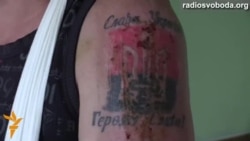 Викрадений сепаратистами шахтар розповів про катування в полоні Викрадений сепаратистами шахтар розповів про катування в полоні