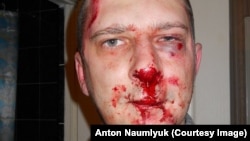 На снимке: саратовский журналист Сергей Вилков после нападения неизвестных 