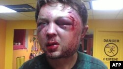 В Киеве жестоко избит консультант FEMEN Виктор Святский