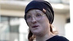 Bjeloruska komičarka s invaliditetom nastavlja rad u egzilu Bjeloruska komičarka s invaliditetom nastavlja rad u egzilu