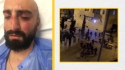 ერეკლე ლოლაძე კლინიკაში სახეზე დაზიანებებით და კადრი ვიდეოდან, რომელზეც მისი და მისი ძმის ცემაა ასახული