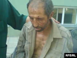 ე.წ. სამხრეთ ოსეთის ბოევიკების მიერ ტყვედ აყვანილი ერთ-ერთი ქართველი, 2008 წლის 22 აგვისტო.