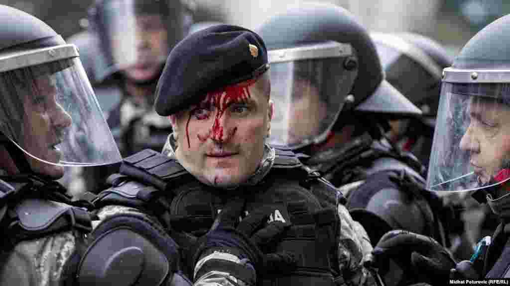 Поліцейський стікає кров'ю після зіткнення з ветеранами війни під час акції протесту в Сараєві, Боснія і Герцеговина, 5 вересня. Кілька сотень ветеранів війни 1992-95 років протестували за збільшення соціальних виплат і єдиний реєстр всіх демобілізованих бійців. (Мідхат Потуровіч, Радіо Свобода/Радіо Вільна Європа) 