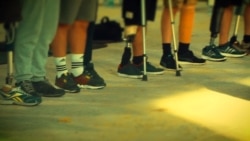 Ампутация: война и поэзия в документальном фильме о трагедии на востоке Украины (видео) Ампутация: война и поэзия в документальном фильме о трагедии на востоке Украины (видео)