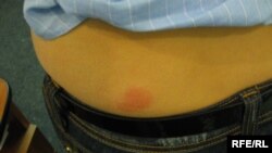 Ось так кусає блоха...