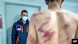A man poses for photographs taken at an outpatient clinic for the Miral camp in Bosnia-Herzegovina. He is one of several migrants there who say they were brutalized and summarily forced back to Bosnia by Croatian law-enforcement
when they tried to cross into the EU.