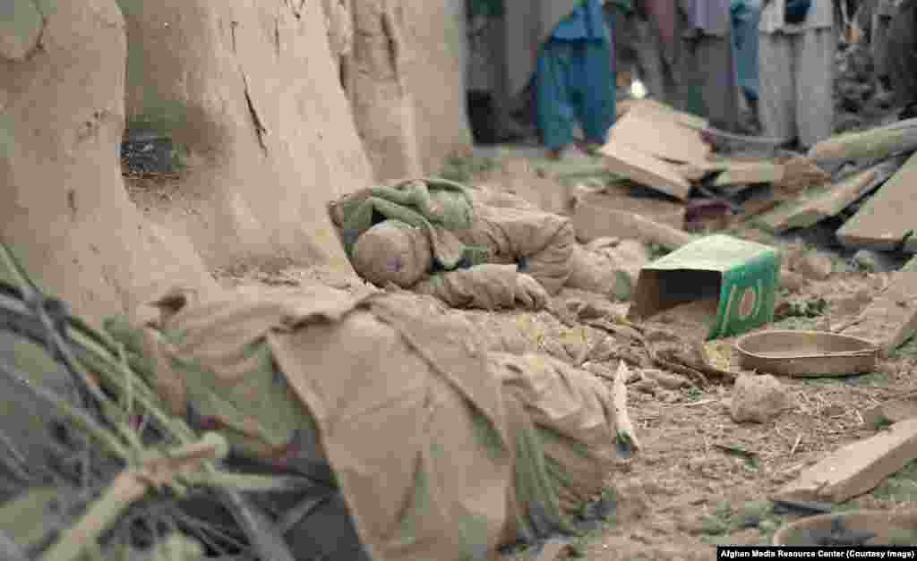Tijelo Afganistanca ubijenog tokom sovjetskog bombardovanja. Najmanje 500.000 Afganistanskih civila je ubijeno a više od pet miliona ili jedna trećina populacije je raseljena.
