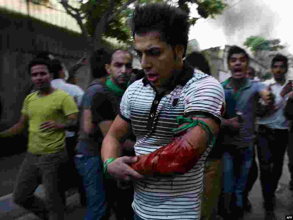 Официальные информационные агентства сообщают о семи убитых в результате столкновений сторонников оппозиции с проправительственной вооруженной группировкой во время демонстраций в понедельник. Многие получили ранения.