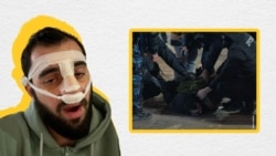 ავთანდილ ტიტვინიძეს დაკავებისას დაუმსხვრიეს სახის ძვლები, ცემისას ღრმა ჭრილობა მიაყენეს თვალთან და როდესაც ჰოსპიტალში მოხვდა აღმოჩნდა რომ ტვინის შერყევაც ჰქონდა. დაკავებიდან ორი კვირის შემდეგ ისევ უჭირს სუნთქვა და ჯერაც ელოდება ჭრილობის შეხორცებას, რომელზეც 7 ნაკერი ადევს.