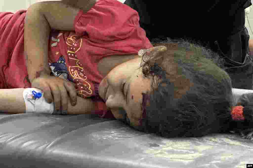 Palestinska djevojčica koja je povrijeđena u izraelskim napadima prima njegu u bolnici Nasser u Khan Yunisu na jugu Pojasa Gaze 15. maja 2025.2025.