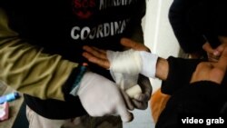 Migrant koji je zadobio povrede od hrvatske policije u BiH