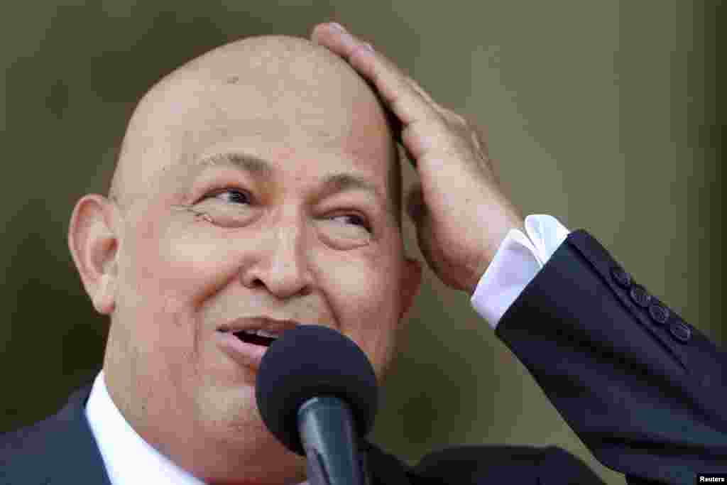 Чавес жартує про свою лисину внаслідок лікування від раку. Фото зняте під час спілкування з журналістами у Каракасі в серпні 2011 року.