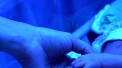 Doktor u borbi za spas prijevremeno rođenih beba u Donbasu Doktor u borbi za spas prijevremeno rođenih beba u Donbasu