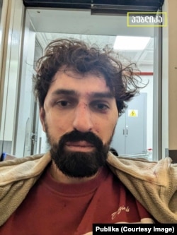 ალექსანდრე ქეშელაშვილი მას შემდეგ, რაც დააკავეს და ფიზიკურად გაუსწორდნენ