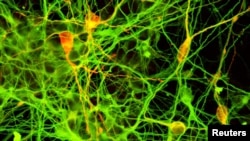 Дофамінергічні нейрони, отримані з плюрипотентних клітин людини, які можуть розвинутись у будь-які інші клітини організму