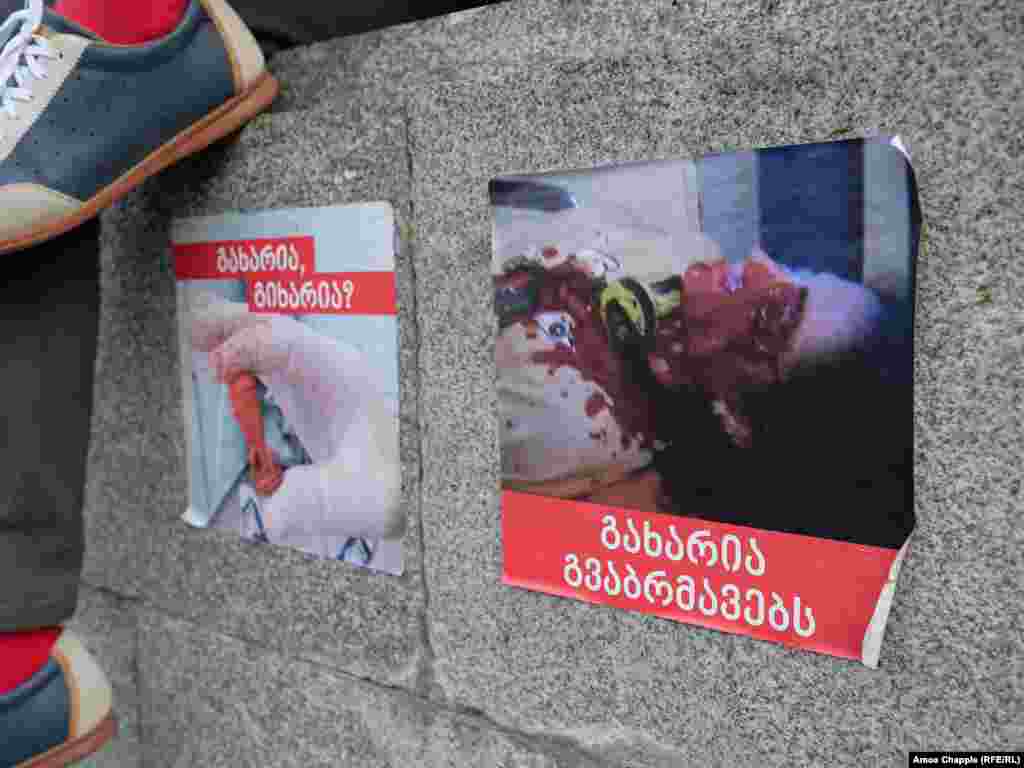 Plakat za koji demonstranti kažu da prikazuje povrijeđenog demonstranta na koga je ispaljen gumeni metak 20. juna