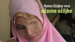 Nova šansa za pakistanske žene - žrtve napada kiselinom Nova šansa za pakistanske žene - žrtve napada kiselinom