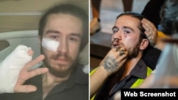 მარცხენა ფოტო: ლასლო რობერტ მეზეში. მარჯვენა ფოტო: მარიამ ნიკურაძე/OC Media