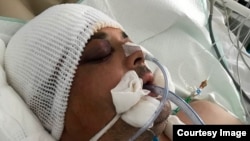 Roman Sopin umro je nekoliko dana nakon što je primljen u bolnicu s teškom povredom glave, za koju njegova porodica sumnja da je rezultat nasilja dok je bio u pritvoru.