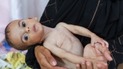 Obitelji u Gazi sve teže do hrane Obitelji u Gazi sve teže do hrane