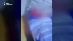 ლუკას დაზიანებები ლუკას დაზიანებები