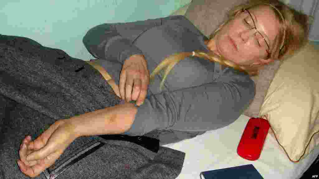 Ukrajina - Bivša premijerka Julija Timošenko pretučena je u zatvoru, te je dopremljena u bolnicu na liječenje, 25. april 2012. Foto: AFP / Ukrayinska Pravda