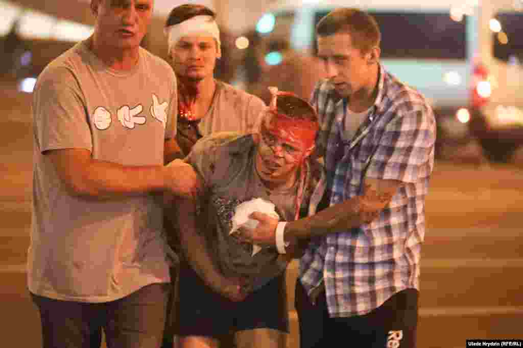 Povređeni muškarac dobija pomoć u Minsku. Policija je na demonstrante ispalila gumene metke, šok bombe i suzavac jer su optužili predsednika Aleksandra Lukašenka da je falsifikovao rezultate predsedničkih izbora u toj zemlji 9. avgusta. 