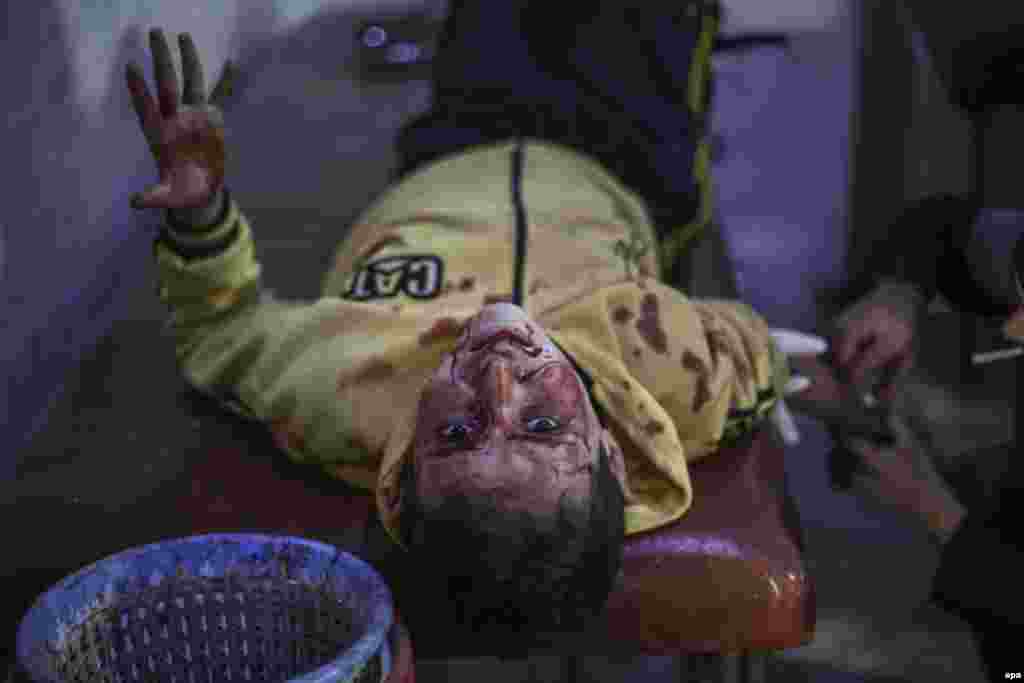 Сириялъул хIукуматалъул рахъ кколез щвезабураб авиакьабиялда лъукъараб лъимадуе кумек гьабулеб буго авлахъалъул госпиталалда. 10 ноябралда гьеб авиакьабиялъ чIван вуго 10 гIадатияв чи. Гьедин лъазабулеб буго оппозициялъ. (EPA / Мухаммед Бадра)  