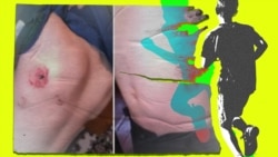 ამ ფოტოებზე ჩანს სისხლჩაქცევების მსგავსი დაზიანებები. შვიდი წლის ბიჭი ამბობს, რომ მასზე დედამ და ბებიამ იძალადეს. ილუსტრირებული ფოტო