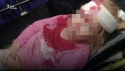 Інтерв'ю з батьками 5-річної дівчинки, пораненої 11 серпня в Білорусі – відео Інтерв'ю з батьками 5-річної дівчинки, пораненої 11 серпня в Білорусі – відео