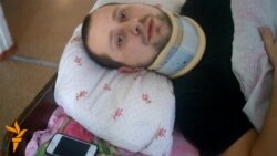 На Донеччині приватна шахта не хотіла визнавати виробничу травму гірника На Донеччині приватна шахта не хотіла визнавати виробничу травму гірника